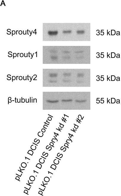 Spry1 Antibodies - Antibody Search Engine - Citeab