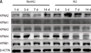 Fig.1.A showing Western Blotting from the publication: KPNA2 promotes angiogenesis by regulating STAT3 phosphorylation.