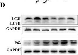Fig.6.D showing Western Blotting in a Gallus gallus domesticus (Chicken) sample from the publication: α-Lipoic Acid Ameliorates Arsenic-Induced Lipid Disorders by Promoting Peroxisomal β-Oxidation and Reducing Lipophagy in Chicken Hepatocyte.