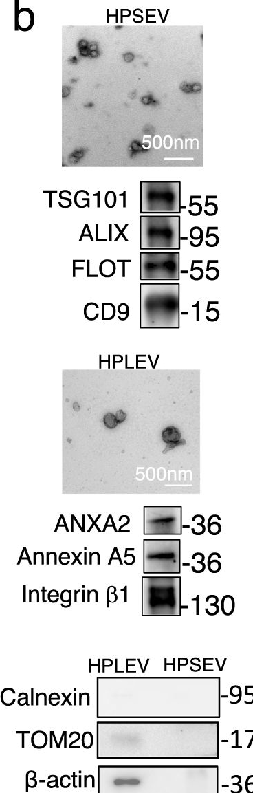 Fig.1.B showing Western Blotting in a Homo sapiens (Human) sample from the publication: Deep proteomic analysis of obstetric antiphospholipid syndrome by DIA-MS of extracellular vesicle enriched fractions.