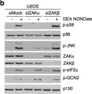 Fig.2.B showing Western Blotting from the publication: Nitric oxide-induced ribosome collision activates ribosomal surveillance mechanisms.