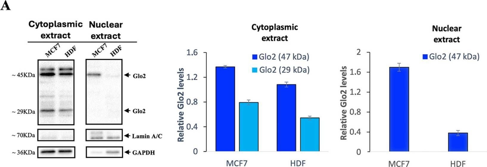Fig.1.A showing Western Blotting in a Homo sapiens (Human) sample from the publication: Overexpression of Glyoxalase 2 in Human Breast Cancer Cells: Implications for Cell Proliferation and Doxorubicin Resistance.