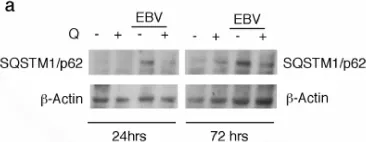 Fig.3.A showing Western Blotting in a Homo sapiens (Human) sample from the publication: Quercetin Interrupts the Positive Feedback Loop Between STAT3 and IL-6, Promotes Autophagy, and Reduces ROS, Preventing EBV-Driven B Cell Immortalization.
