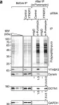 Fig.8.A showing Western Blotting in a Homo sapiens (Human) sample from the publication: YTHDF2 facilitates aggresome formation via UPF1 in an m6A-independent manner.
