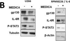 Fig.3.B showing Western Blotting in a Homo sapiens (Human) sample from the publication: Suppression of multiple myeloma by mitochondrial targeting.