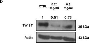 Fig.6.D showing Western Blotting from the publication: Effect of Soluble Factors Released from Porcine Freeze-Dried Lung Tissue (FDLT) on Modulation of Cell Growth and EMT Signature in Non-Small Cell Lung Cancer (NSCLC)-A Preliminary In Vitro Study.