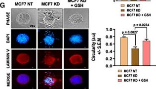 Fig.2.G showing Immunocytochemistry-immunofluorescence from the publication: Merlin deficiency alters the redox management program in breast cancer.