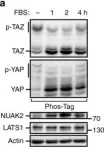 Fig.4.A showing Western Blotting from the publication: A feed forward loop enforces YAP/TAZ signaling during tumorigenesis.