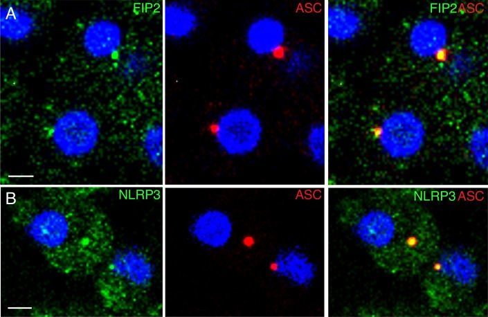 Fig.4.A showing Immunocytochemistry-immunofluorescence in a Homo sapiens (Human) sample from the publication: GTPase Rab11b and effector Rab11-FIP2 promote NLRP3 stability during inflammasome priming.