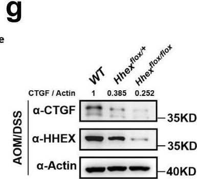 Fig.4.G showing Western Blotting in a Mus musculus (House mouse) sample from the publication: CK2-induced cooperation of HHEX with the YAP-TEAD4 complex promotes colorectal tumorigenesis.