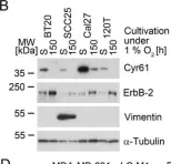 Fig.2.B showing Western Blotting in a Homo sapiens (Human) sample from the publication: Cysteine-Rich Angiogenic Inducer 61: Pro-Survival Function and Role as a Biomarker for Disseminating Breast Cancer Cells.