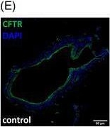Fig.2.E showing Immunohistochemistry-immunofluorescence from the publication: Heavy metals in cigarette smoke strongly inhibit pancreatic ductal function and promote development of chronic pancreatitis.