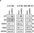 Fig.6.D showing Western Blotting from the publication: Transcription Factor NRF2 Participates in Cell Cycle Progression at the Level of G1/S and Mitotic Checkpoints.