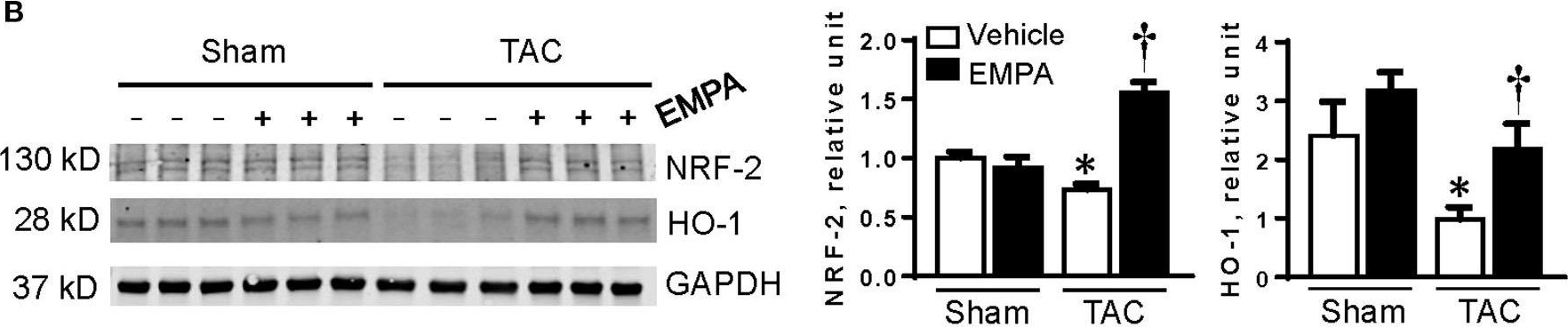 Fig.2.B showing Western Blotting in a Mus musculus (House mouse) sample from the publication: Direct Cardiac Actions of Sodium-Glucose Cotransporter 2 Inhibition Improve Mitochondrial Function and Attenuate Oxidative Stress in Pressure Overload-Induced Heart Failure.