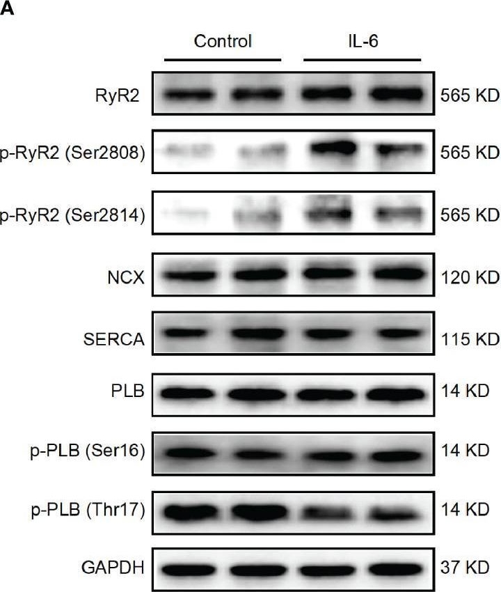 Fig.8.A showing Western Blotting in a Rattus norvegicus (Rat) sample from the publication: Interleukin-6-Mediated-Ca2+ Handling Abnormalities Contributes to Atrial Fibrillation in Sterile Pericarditis Rats.