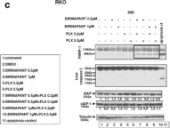 Fig.4.C showing Western Blotting in a Homo sapiens (Human) sample from the publication: IAP antagonists Birinapant and AT-406 efficiently synergise with either TRAIL, BRAF, or BCL-2 inhibitors to sensitise BRAFV600E colorectal tumour cells to apoptosis.