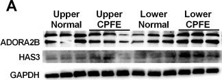 Fig.7.A showing Western Blotting in a Homo sapiens (Human) sample from the publication: Adenosine and hyaluronan promote lung fibrosis and pulmonary hypertension in combined pulmonary fibrosis and emphysema.