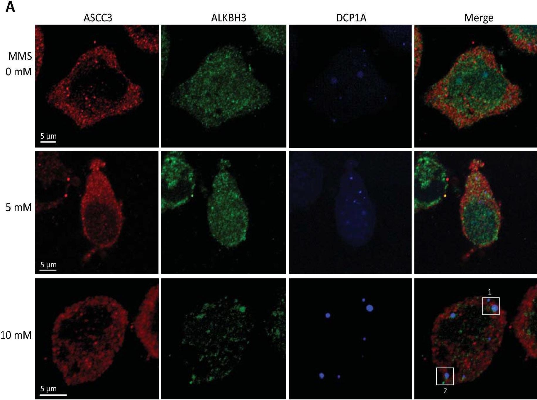 Fig.6.A showing Immunocytochemistry-immunofluorescence in a Homo sapiens (Human) sample from the publication: ALKBH3 partner ASCC3 mediates P-body formation and selective clearance of MMS-induced 1-methyladenosine and 3-methylcytosine from mRNA.