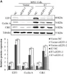 Fig.4.A showing Western Blotting from the publication: The lysine acetyltransferase GCN5 contributes to human papillomavirus oncoprotein E7-induced cell proliferation via up-regulating E2F1.
