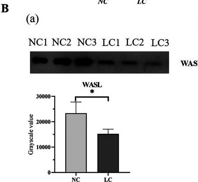Fig.5.B showing Western Blotting in a Homo sapiens (Human) sample from the publication: Lymphocyte migration regulation related proteins in urine exosomes may serve as a potential biomarker for lung cancer diagnosis.