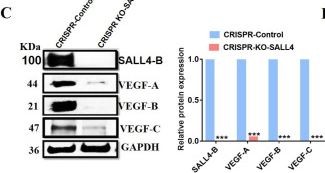Fig.5.C showing Western Blotting from the publication: SALL4 promotes angiogenesis in gastric cancer by regulating VEGF expression and targeting SALL4/VEGF pathway inhibits cancer progression.