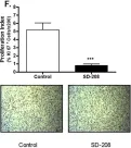 Fig.6.F showing Immunohistochemistry in a Homo sapiens (Human) sample from the publication: SD-208, a novel protein kinase D inhibitor, blocks prostate cancer cell proliferation and tumor growth in vivo by inducing G2/M cell cycle arrest.