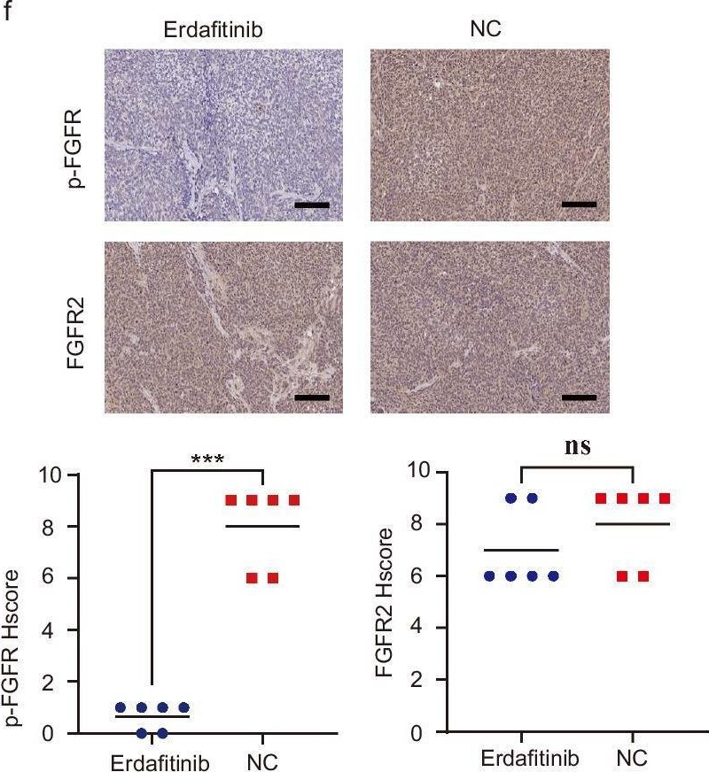 Fig.3.F showing Immunohistochemistry from the publication: Single-cell analysis reveals transcriptomic features and therapeutic targets in primary pulmonary lymphoepithelioma-like carcinoma.