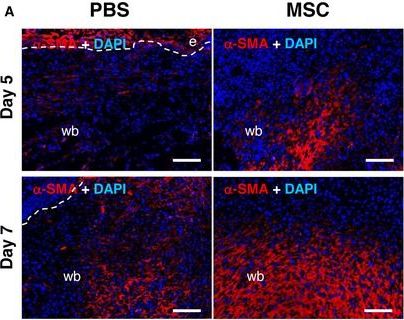 MSCs rescue impaired wound healing in a murine LAD1 model by adaptive responses to low TGF-β1 levels.