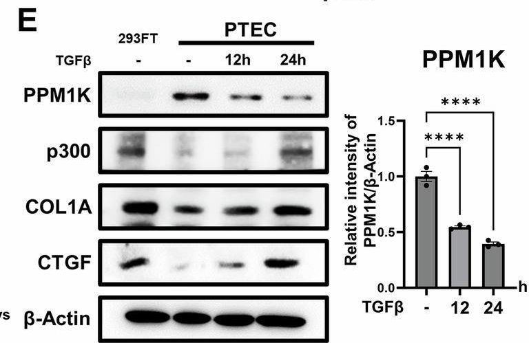 Fig.3.E showing Western Blotting from the publication: Loss of p300 in proximal tubular cells reduces renal fibrosis and endothelial-mesenchymal transition.