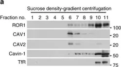 Fig.3.A showing Western Blotting in a Homo sapiens (Human) sample from the publication: ROR1 sustains caveolae and survival signalling as a scaffold of cavin-1 and caveolin-1.