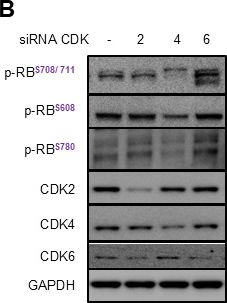 Fig.2.B showing Western Blotting from the publication: A CDK-4EBP1 signaling axis drives HSV-1 replication and underscores a druggable pathway for potent antiviral intervention.