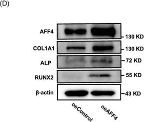Fig.2.D showing Western Blotting in a Homo sapiens (Human) sample from the publication: AFF4 regulates osteogenic potential of human periodontal ligament stem cells via mTOR-ULK1-autophagy axis.