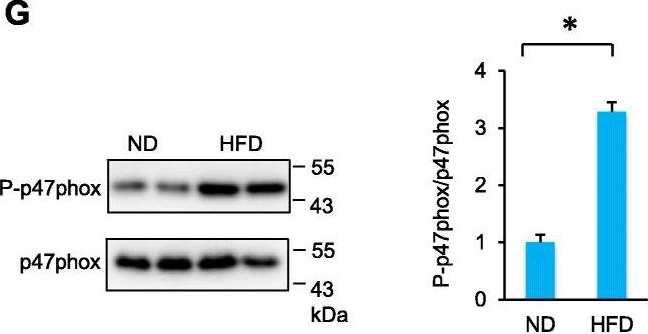 Fig.5.G showing Western Blotting from the publication: Diet-induced obesity impairs spermatogenesis: the critical role of NLRP3 in Sertoli cells.