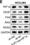 Fig.6.E showing Western Blotting in a Homo sapiens (Human) sample from the publication: N6-Methyladenosine Modification of circIST1 Promotes Hypoxia-Inducible Factor α-mediated Glycolysis and Progression in Hepatocellular Carcinoma.