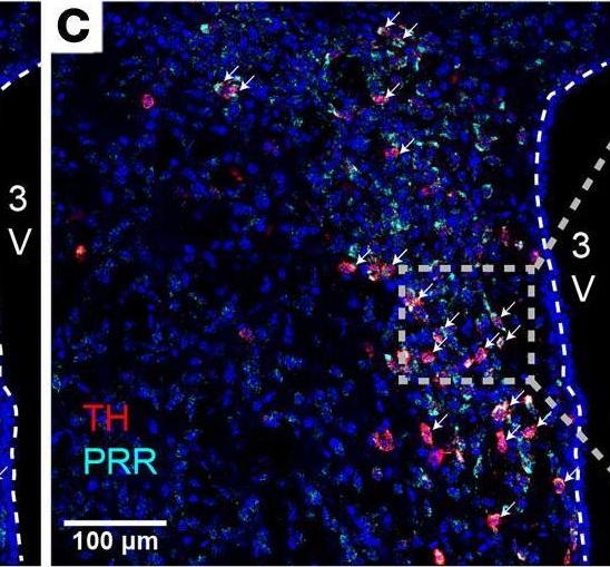 Fig.1.C showing Immunohistochemistry-immunofluorescence in a Mus musculus (House mouse) sample from the publication: (Pro)renin receptor signaling in hypothalamic tyrosine hydroxylase neurons is required for obesity-associated glucose metabolic impairment.