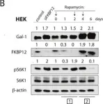 Fig.7.B showing Western Blotting from the publication: Rapalogs can promote cancer cell stemness in vitro in a Galectin-1 and H-ras-dependent manner.