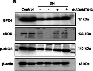 Fig.5.B showing Western Blotting in a Mus musculus (House mouse) sample from the publication: ADAMTS13 ameliorates diabetic nephropathy by Nrf2/GPX4/eNOS signaling pathway.