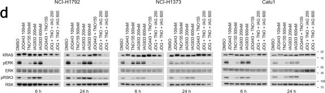 Fig.9.D showing Western Blotting in a Homo sapiens (Human) sample from the publication: Direct and selective pharmacological disruption of the YAP-TEAD interface by IAG933 inhibits Hippo-dependent and RAS-MAPK-altered cancers.