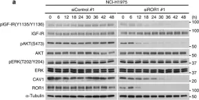 Fig.7.A showing Western Blotting in a Homo sapiens (Human) sample from the publication: ROR1 sustains caveolae and survival signalling as a scaffold of cavin-1 and caveolin-1.