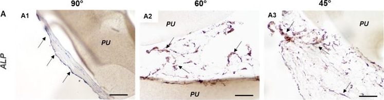 Fig.7.A showing Immunohistochemistry from the publication: An Osteosarcoma Model by 3D Printed Polyurethane Scaffold and In Vitro Generated Bone Extracellular Matrix.