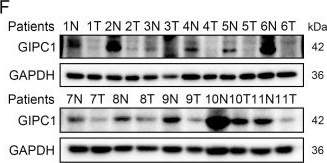 Fig.1.F showing Western Blotting from the publication: GIPC1 Restrains the Progression and Chemoresistance of Colorectal Cancer by Regulating TTC7B/mTOR/NF-κB Axis.