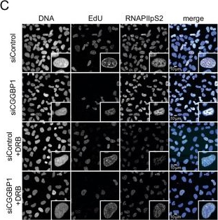 Fig.3.C showing Immunocytochemistry-immunofluorescence in a Homo sapiens (Human) sample from the publication: The CGG triplet repeat binding protein 1 counteracts R-loop induced transcription-replication stress.