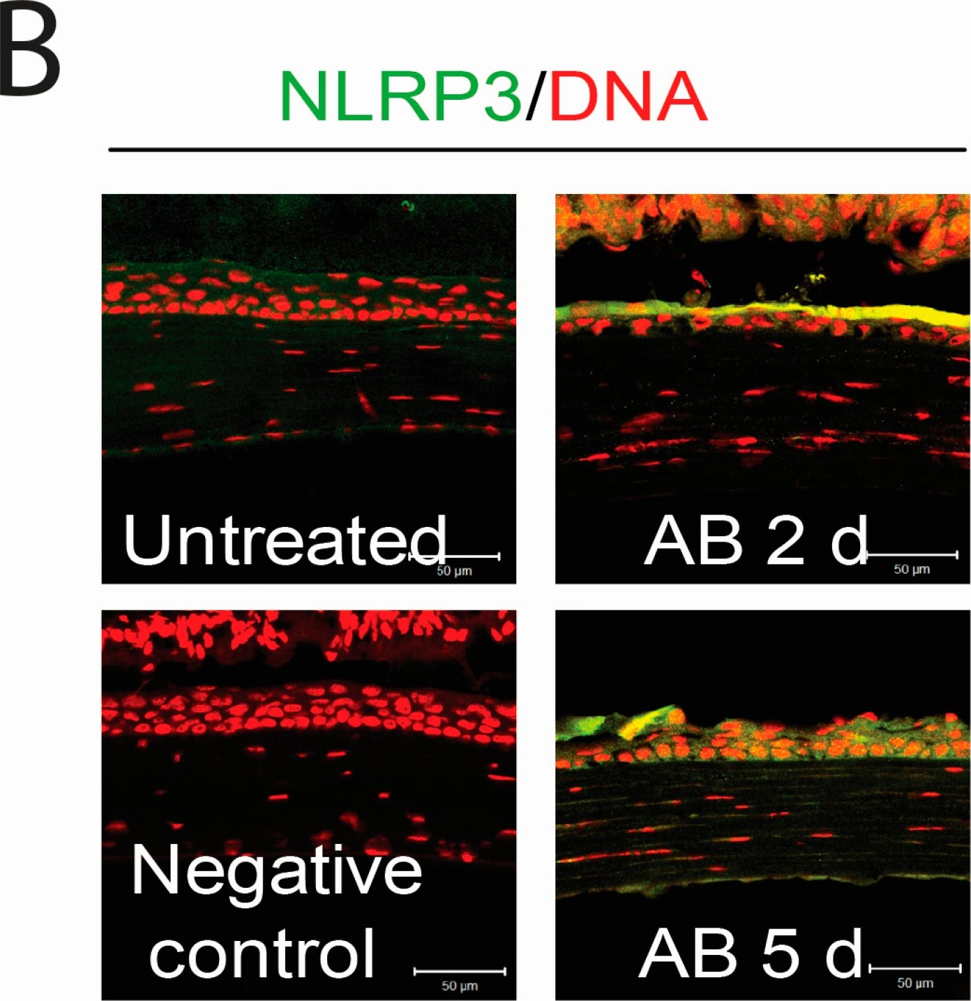 NLRP3 antibodies - Antibody search engine - CiteAb