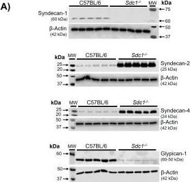 Fig.3.A showing Western Blotting in a Mus musculus (House mouse) sample from the publication: Heparan Sulfates Regulate Vascular Reactivity in Syndecan 1 Knockout Mice.