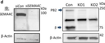 Fig.4.D showing Western Blotting from the publication: Computational ranking identifies Plexin-B2 in circulating tumor cell clustering with monocytes in breast cancer metastasis.
