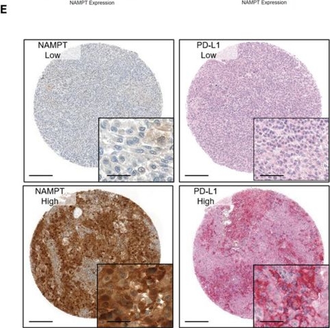 Fig.2.E showing Immunohistochemistry from the publication: Bi-directional regulation between NAD/NAMPT and IFN-γ/PD-L1 axes via BRD4/IRF1 and mitochondrial respiration in metastatic cutaneous melanoma.