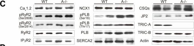 Fig.1.C showing Western Blotting in a Mus musculus (House mouse) sample from the publication: TRIC-A Loss Sensitizes the Heart to β-Adrenergic Stress and Drives Cardiomyocyte Death and Fibrosis.