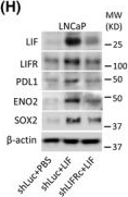 Fig.1.H showing Western Blotting in a Homo sapiens (Human) sample from the publication: Immunosuppressive role of BDNF in therapy-induced neuroendocrine prostate cancer.