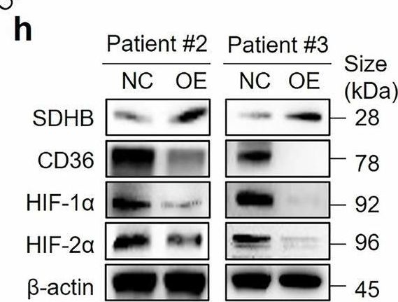 Fig.4.N showing Western Blotting in a Homo sapiens (Human) sample from the publication: Olverembatinib, a multikinase inhibitor that modulates lipid metabolism, in advanced succinate dehydrogenase-deficient gastrointestinal stromal tumors: a phase 1b study and translational research.