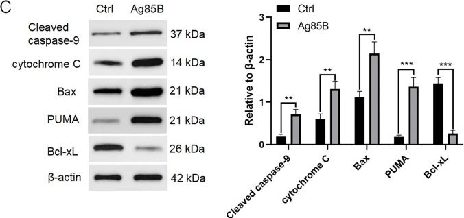 Fig.4.C showing Western Blotting from the publication: Mycobacterial antigen Ag85B restrains Hodgkin lymphoma tumor growth by inhibiting autophagy.